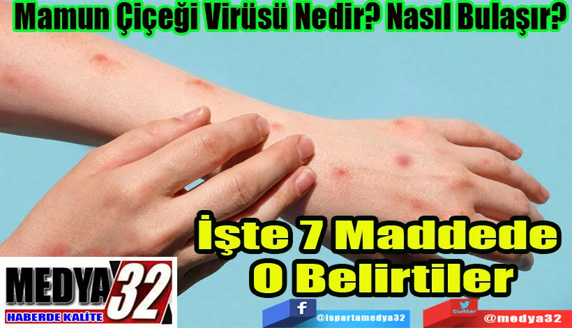 Mamun Çiçeği Virüsü Nedir? Nasıl Bulaşır? İşte 7 Maddede O Belirtiler 