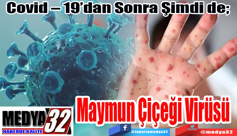 Covid – 19’dan Sonra Şimdi de;  Maymun Çiçeği Virüsü 